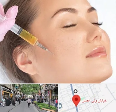 آموزش تزریق ژل و بوتاکس در ولیعصر شهریار