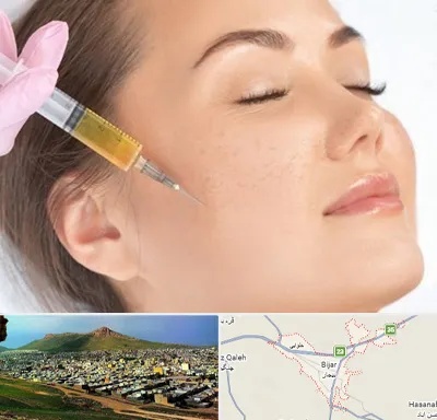 آموزش تزریق ژل و بوتاکس در بیجار