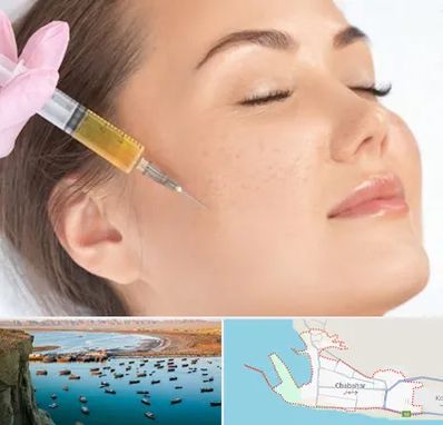 آموزش تزریق ژل و بوتاکس در چابهار