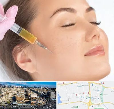 آموزش تزریق ژل و بوتاکس در شهرک راه آهن 