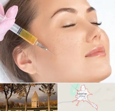 آموزش تزریق ژل و بوتاکس در تویسرکان