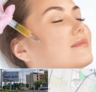 آموزش تزریق ژل و بوتاکس در فاز یک اندیشه