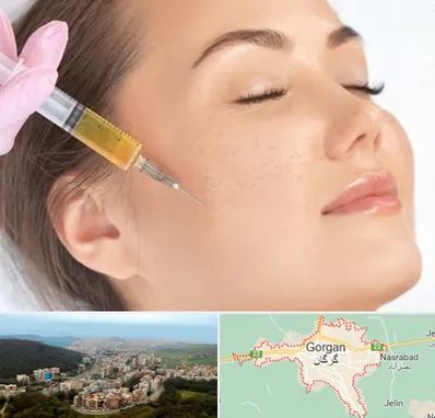 آموزش تزریق ژل و بوتاکس در گرگان