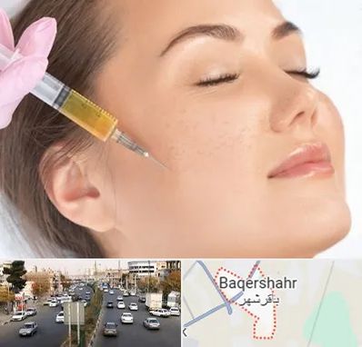 آموزش تزریق ژل و بوتاکس در باقرشهر