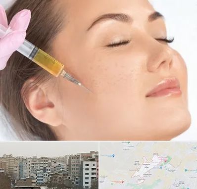 آموزش تزریق ژل و بوتاکس در محمد شهر کرج 