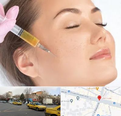 آموزش تزریق ژل و بوتاکس در شهناز تبریز