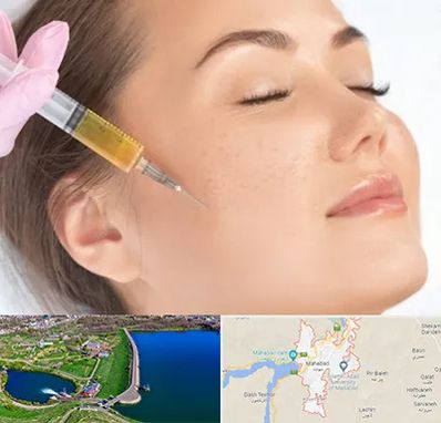 آموزش تزریق ژل و بوتاکس در مهاباد