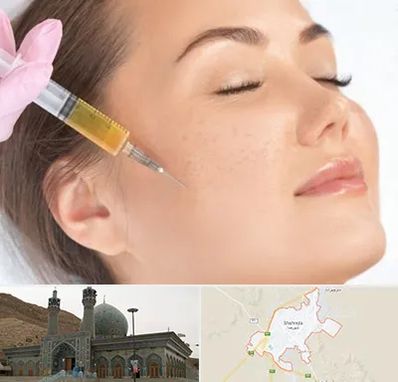 آموزش تزریق ژل و بوتاکس در شهرضا