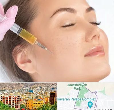 آموزش تزریق ژل و بوتاکس در نیاوران 