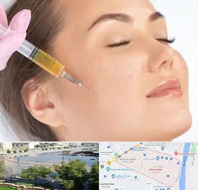 آموزش تزریق ژل و بوتاکس در گلستان اهواز 