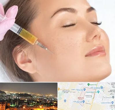 آموزش تزریق ژل و بوتاکس در مارلیک کرج 