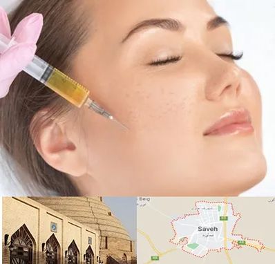 آموزش تزریق ژل و بوتاکس در ساوه