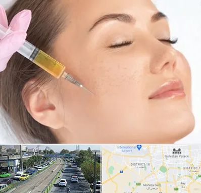 آموزش تزریق ژل و بوتاکس در جنوب تهران 