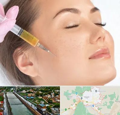 آموزش تزریق ژل و بوتاکس در مراغه