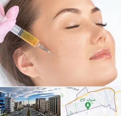 آموزش تزریق ژل و بوتاکس در سعادت آباد 