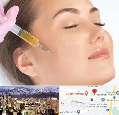 آموزش تزریق ژل و بوتاکس در جردن 