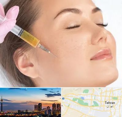 آموزش تزریق ژل و بوتاکس در غرب تهران 