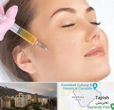 آموزش تزریق ژل و بوتاکس در زعفرانیه 