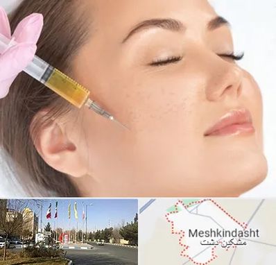 آموزش تزریق ژل و بوتاکس در مشکین دشت