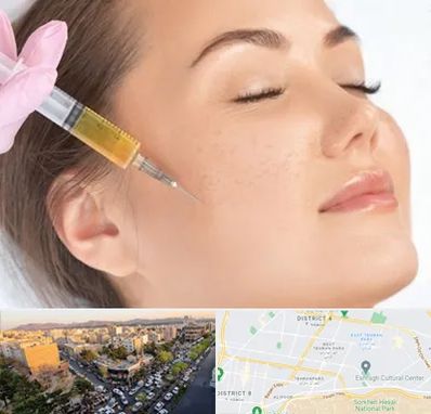 آموزش تزریق ژل و بوتاکس در تهرانپارس 