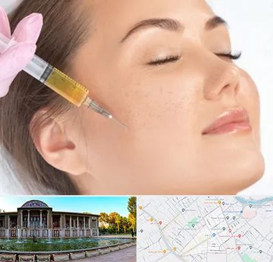 آموزش تزریق ژل و بوتاکس در عفیف آباد شیراز 