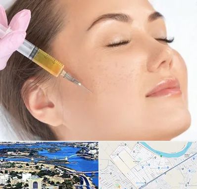 آموزش تزریق ژل و بوتاکس در کوروش اهواز 