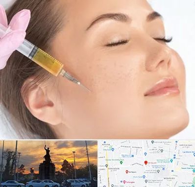 آموزش تزریق ژل و بوتاکس در میدان حر 