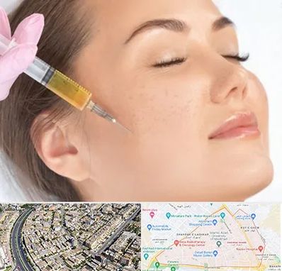 آموزش تزریق ژل و بوتاکس در شهرک غرب مشهد 