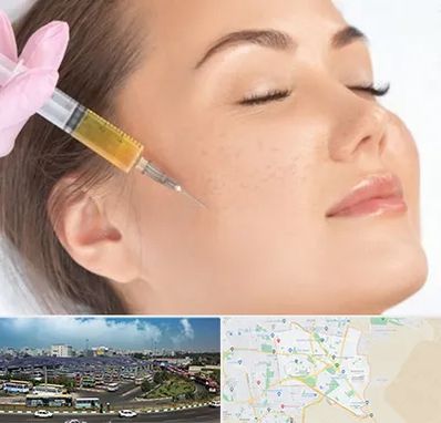 آموزش تزریق ژل و بوتاکس در منطقه 15 تهران 