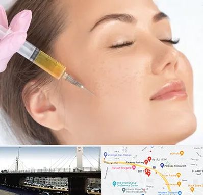 آموزش تزریق ژل و بوتاکس در پارک وی 