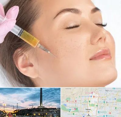 آموزش تزریق ژل و بوتاکس در منطقه 2 تهران 