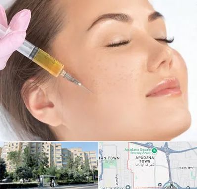 آموزش تزریق ژل و بوتاکس در آپادانا