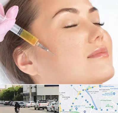 آموزش تزریق ژل و بوتاکس در قدوسی شرقی شیراز 