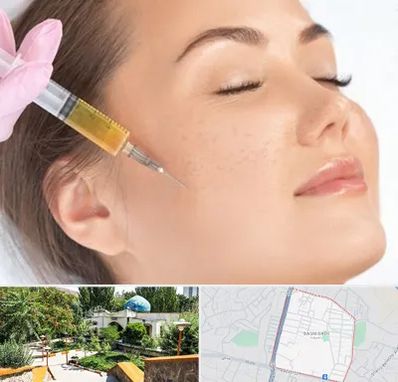 آموزش تزریق ژل و بوتاکس در باغمیشه تبریز