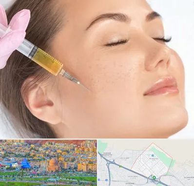 آموزش تزریق ژل و بوتاکس در رشدیه تبریز