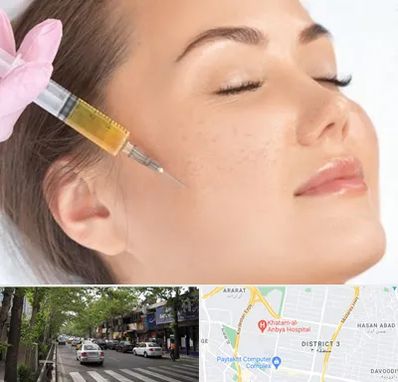 آموزش تزریق ژل و بوتاکس در ظفر 