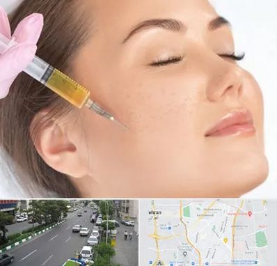 آموزش تزریق ژل و بوتاکس در ستارخان 