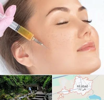 آموزش تزریق ژل و بوتاکس در علی آباد کتول
