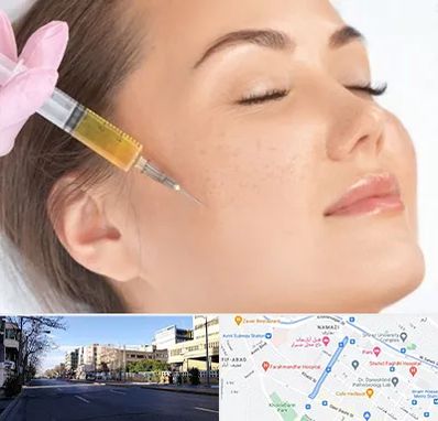 آموزش تزریق ژل و بوتاکس در خیابان ملاصدرا شیراز 