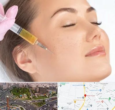 آموزش تزریق ژل و بوتاکس در سبلان 