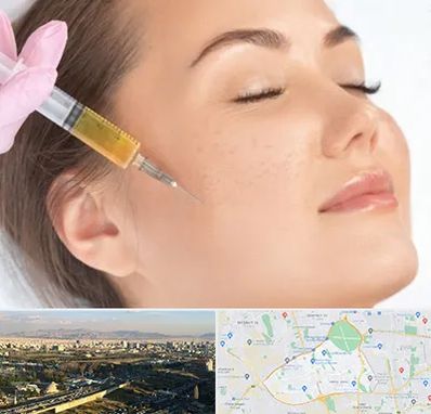 آموزش تزریق ژل و بوتاکس در منطقه 19 تهران 