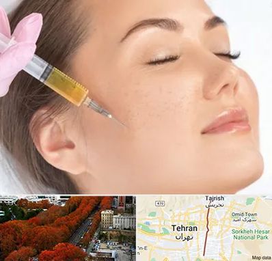 آموزش تزریق ژل و بوتاکس در ولیعصر 