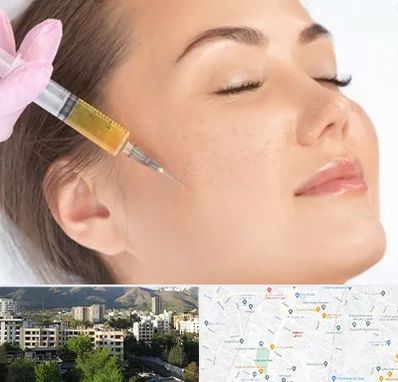 آموزش تزریق ژل و بوتاکس در دیباجی 