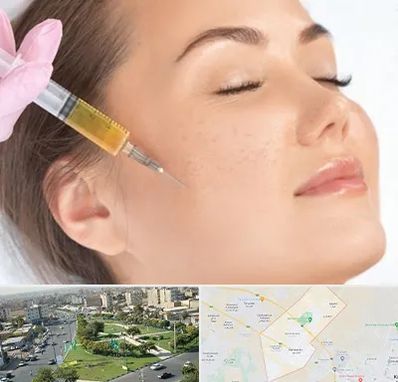 آموزش تزریق ژل و بوتاکس در کمال شهر کرج 