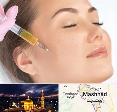 آموزش تزریق ژل و بوتاکس در مشهد