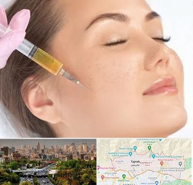 آموزش تزریق ژل و بوتاکس در منطقه 1 تهران 