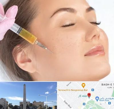 آموزش تزریق ژل و بوتاکس در فلکه گاز شیراز 