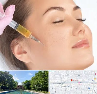 آموزش تزریق ژل و بوتاکس در هشت بهشت اصفهان 