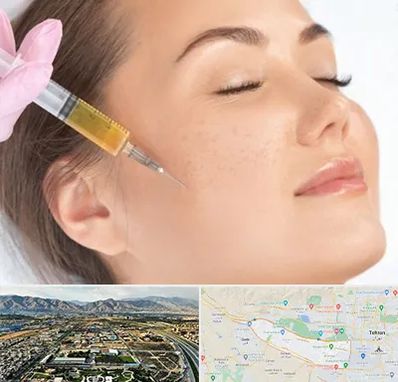 آموزش تزریق ژل و بوتاکس در منطقه 21 تهران 