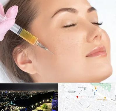 آموزش تزریق ژل و بوتاکس در هفت تیر مشهد 